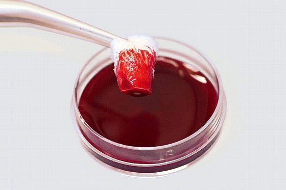 ������� �� ����� ���� ���� 16 ��� 12 �� Botiss Biomaterials Collacone� Collagen Cone