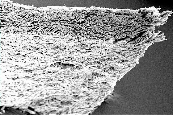 ������� ����� ����� ������ ����� ������ Botiss Biomaterials Collprotect� Membrane