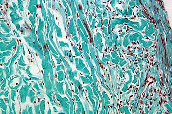 ������� ����� ����� ������ ����� ������ Botiss Biomaterials Collprotect� Membrane