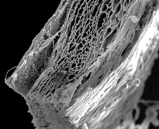 ������� ����� ����� ������� ����� ������ Botiss Biomaterials Jason� Membrane