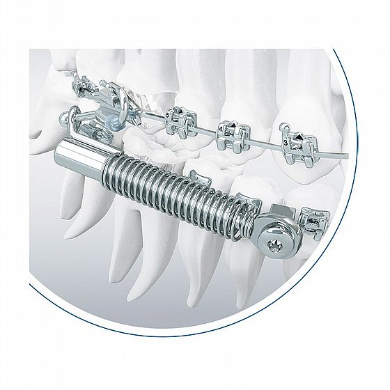 ���� ��������� �� ���� SUS� Start-Set DENTAURUM Sabbagh Universal Spring