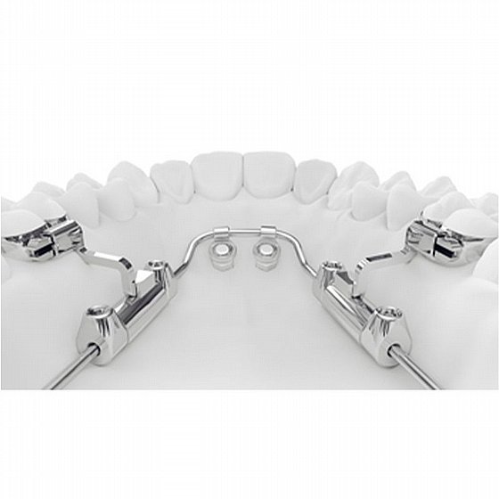 �� ������ ������ ������ ������ Dentaurum Amda� Starter Set (assembled)