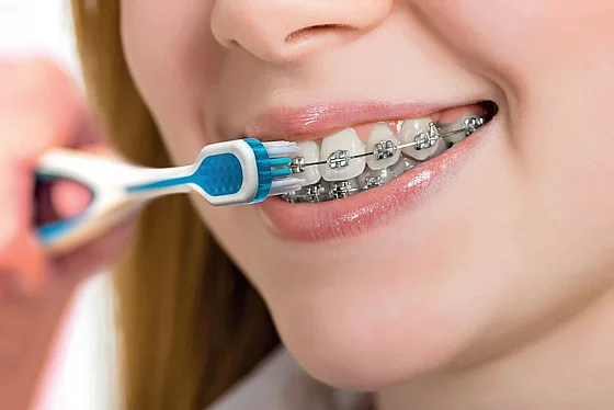 ����� ������ ����� ������ ���������� Edelwhite EW-ORTHO Pro Ortho Toothbrush