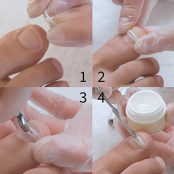 ��� ����� ������ ������ ��������� ��� ������ 8 �� Herbitas PodoStripe� Refill