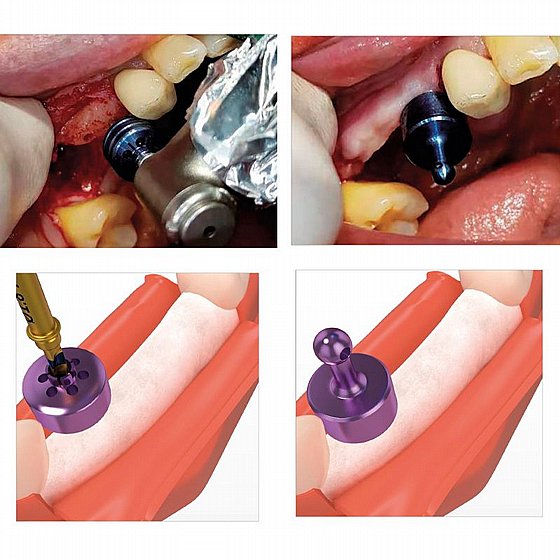 ���� ���� �������� ������ ������ �����  Double A Guide Kit