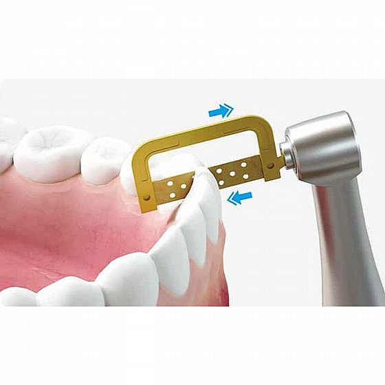 ����� ������ ������ ������ ������� Koungsun Orthodontic inter proximal Reduction (IPR) Motor E360