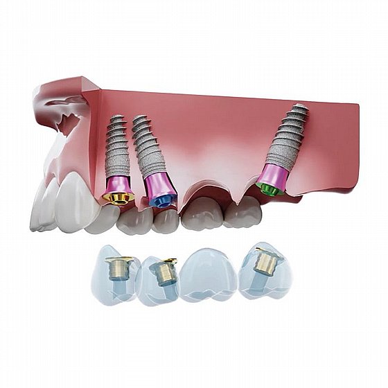 ���� �����-����� Multima Pro IH - ����� ����� ����� 2.42 �"� 
