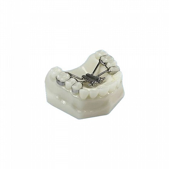 ����� ���� ���������� �� ����� 10 �"� Morelli Rapid Fan Expander "Butterfly" 10mm Opening