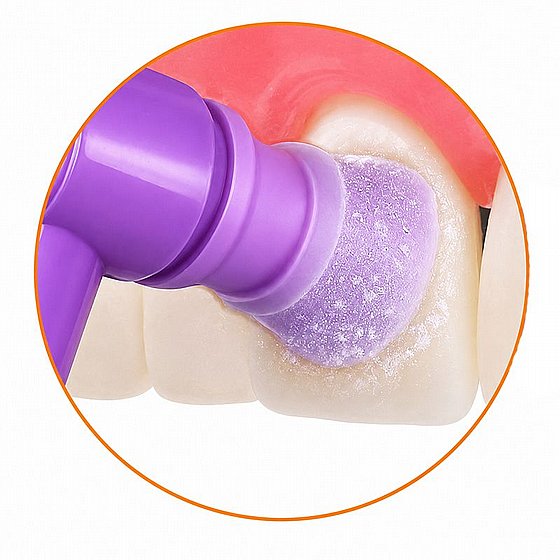 ��� ����� ������ ��-���� �� ����� ����� ����� 144 ��� PacDent ProAngle� Plus Disposable Prophy Angles