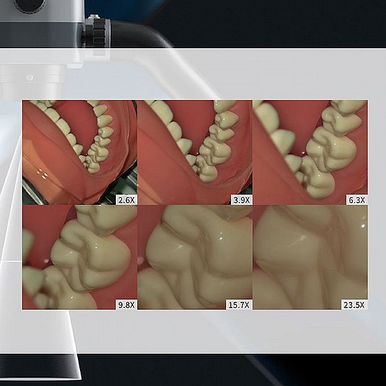 ��������� �����  Eighteeth Microscope AcuVision X