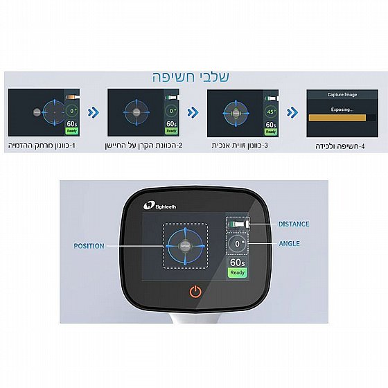 ����� ������ ����� ����� ���� �� ����� ����� ��� Eighteeth HyperLight-M Portable X-Ray Unit
