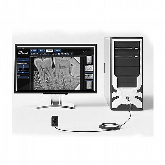 ����� ����� ���������� ������� ����� 1/1.5/2 Eighteeth Dental RVG Sensor Nano Pix