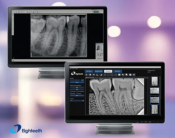 ����� ����� ���������� ������� ����� 1/1.5/2 Eighteeth Dental RVG Sensor Nano Pix