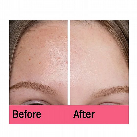 ����� �� ���� ���� ����� �� 5% ������ �������� 10 ������ Skincyclopedia Night Sheet Mask AHA + PHA