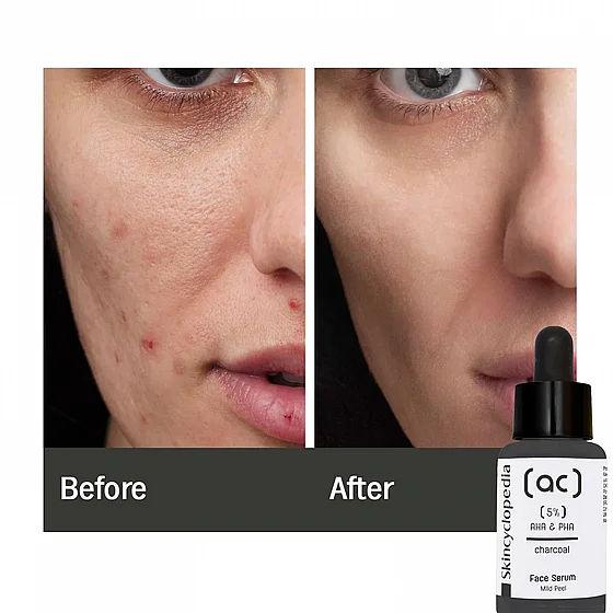 ���� ������ ���� ����� ������ ��� ���� 30 ��� Skincyclopedia Mild Peeling Face 