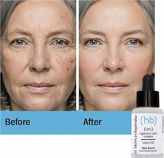���� ���� ���� ����� �� ����� ���������� ������� B5 - 30 ��� Skincyclopedia Serum With Hyaluronic Acid 