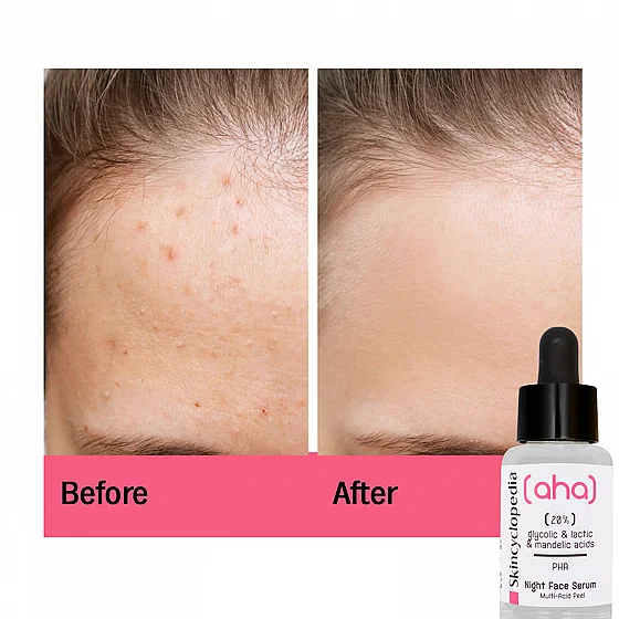 ���� ������ ���� ���� ����� 30 ��� Skincyclopedia Night Serum