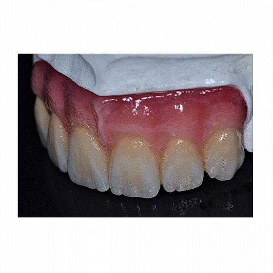 ���� ������ ������ �������� ����� 50 ��� ����� ������ Wohlwend Vision Zirkon Dentin A1-D4