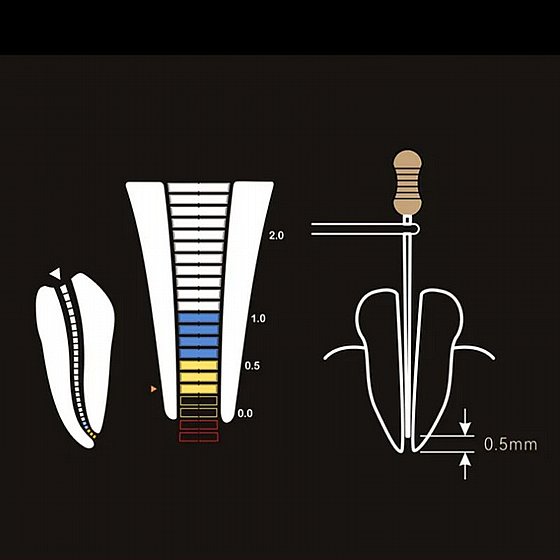 ����� ���� �������� ������ ����� �� ����� ���� ����� ������ ���������� Woodpecker DPEX X Apex Locator Endodontic Root Canal Apical