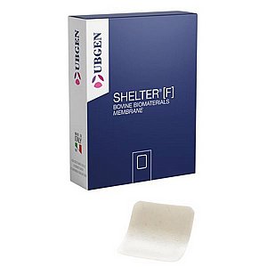 ������� ������ ����� ��� ������ ��� ���� ������ SHELTER�  UBGEN� Membranes Membrane