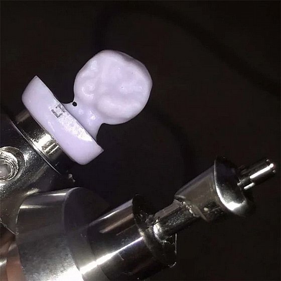 ���� ������ �������� ���� ���� Upcera Lithium Disilicate Ceramic Block for Emax LT C14 