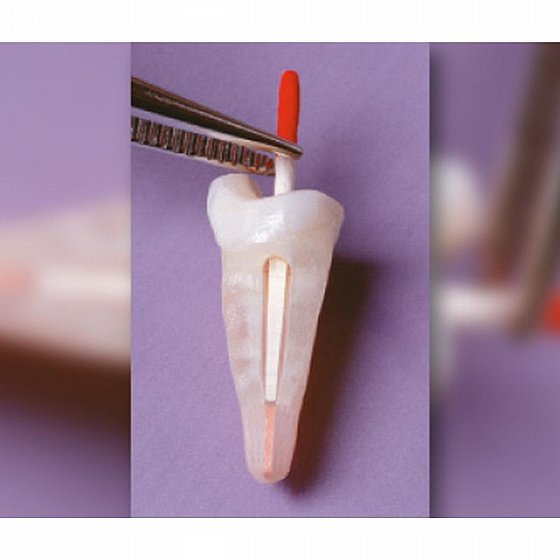 ���� ����� ��� ������� 30 �� Angelus Reforpost 